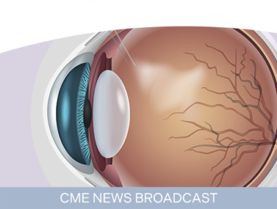 Shaping the Future of Vision-Threatening Diabetic Retinopathy: Adapting to More Durable Anti-VEGF Strategies for DME Treatment