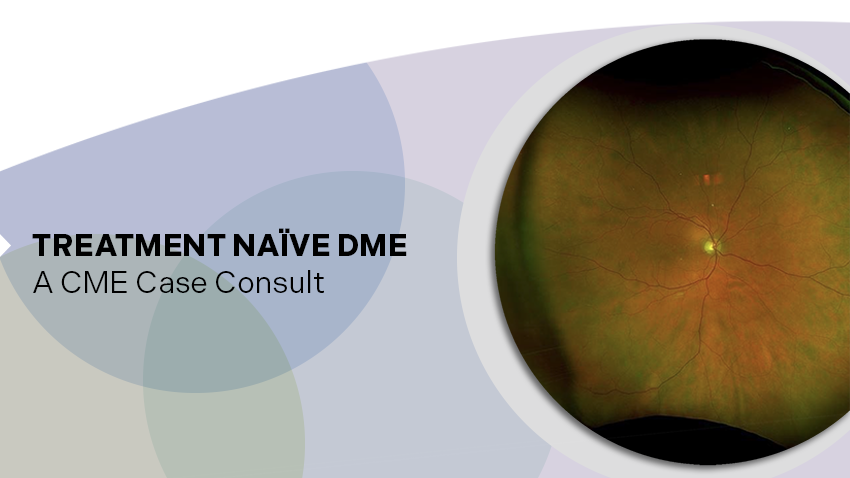 Treatment-Naïve DME - Case Consult