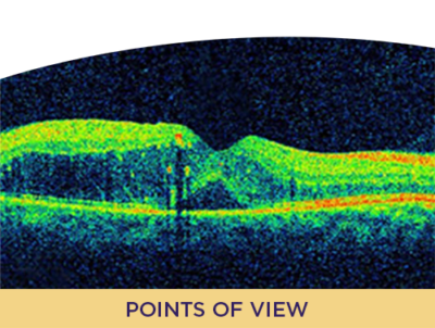 Initiating an IVT Anti-VEGF for DR/DME