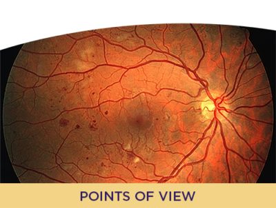 Combining Anti-VEGF Therapy With Steroids for DR/DME