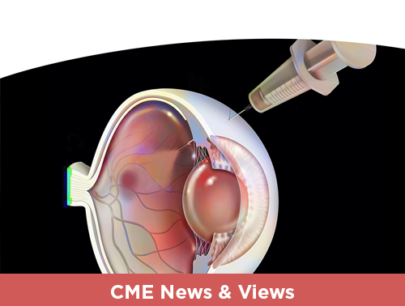 Safety of the New Anti-VEGF Therapies: Findings From Treatment of nAMD
