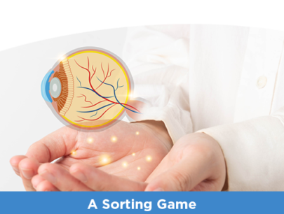 Switching to a New Anti-VEGF Agent for nAMD